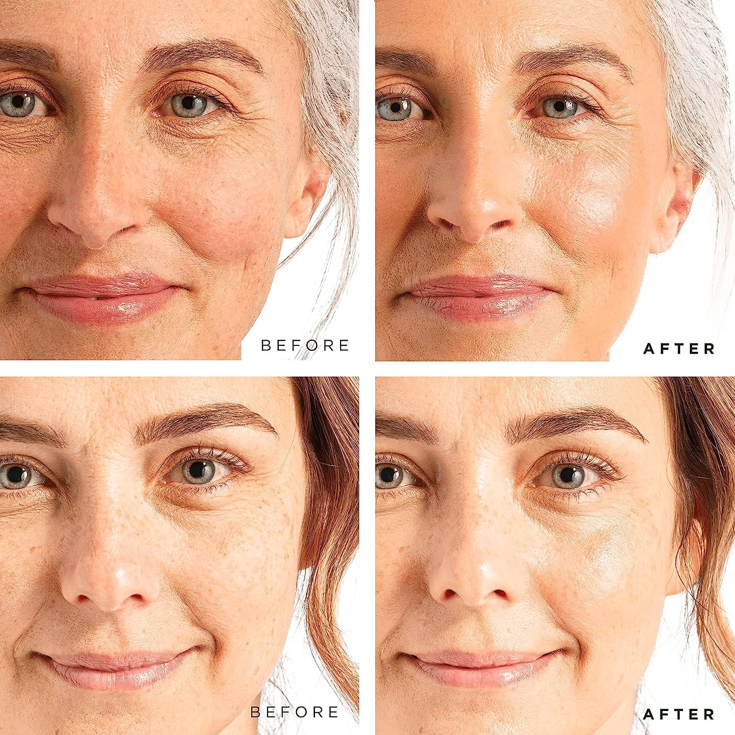 Tree of Life Beauty Facial Skin Care Set, Brightening, Firming, Hydrating, Dry Face, Dermatologist Tested - Retinol Serum and Hydrating Hyaluronic Acid - Skin Care Kit, 2 count of 1 Fl Oz